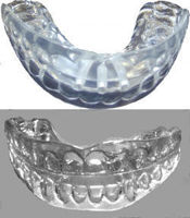 Picture of Adult Ortho-T® Appliance